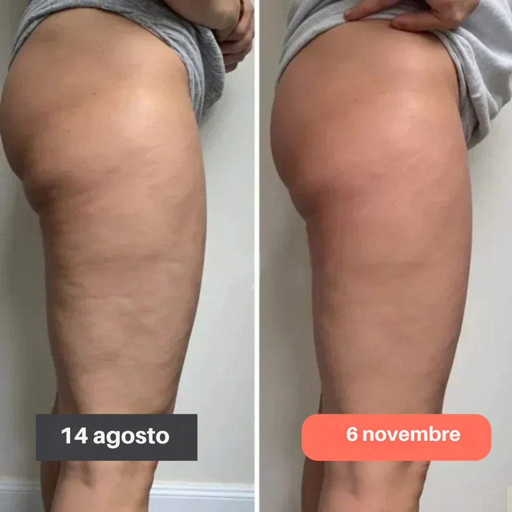 Leggings 3D Fittabella  – Ridefinisci la tua silhouette senza sforzo